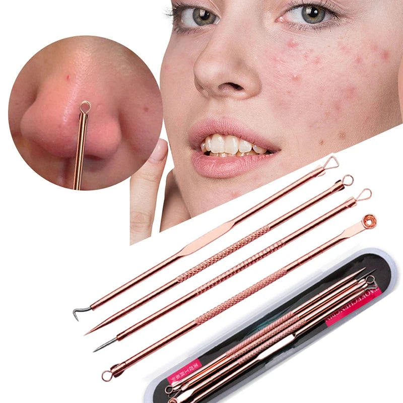 Stainless Steel Blackhead Extractor