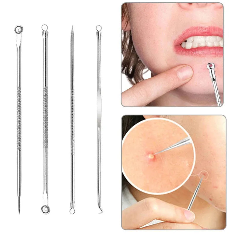 Stainless Steel Blackhead Extractor