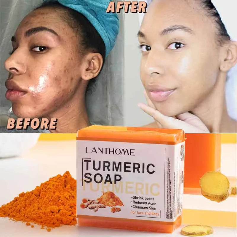 Turmeric Soap Face Cleansing Anti Acne Whitening Skin